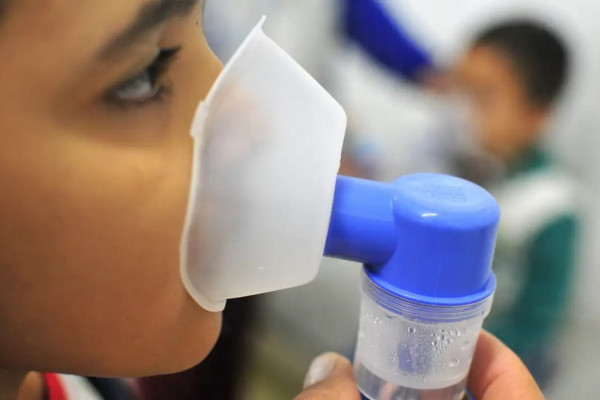 Fiocruz: 72,5% dos óbitos por SRAG estão relacionados à influenza A