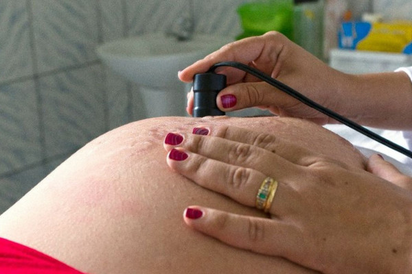 Exame pré-natal reduz chance de bebê nascer com anomalia