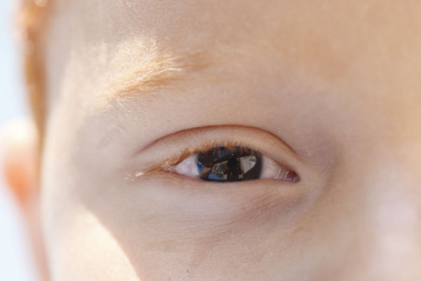 Cartilha sobre saúde ocular na infância orienta pais e professores
