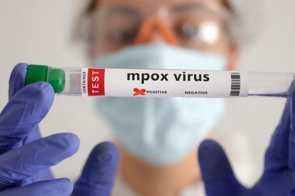 Mpox: África tem quase 50 mil casos confirmados 