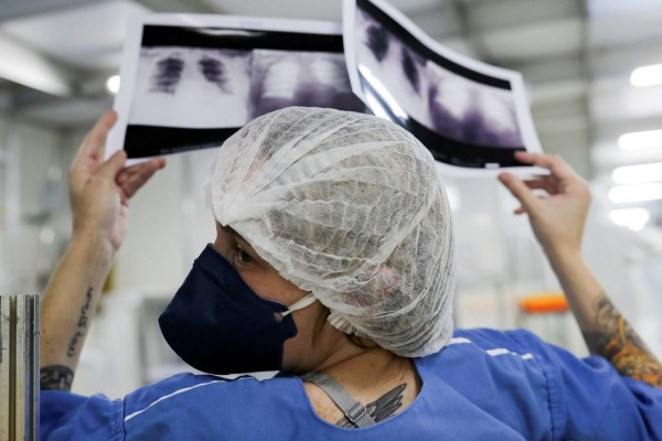Câncer de pulmão: 15% dos casos acontecem em não fumantes