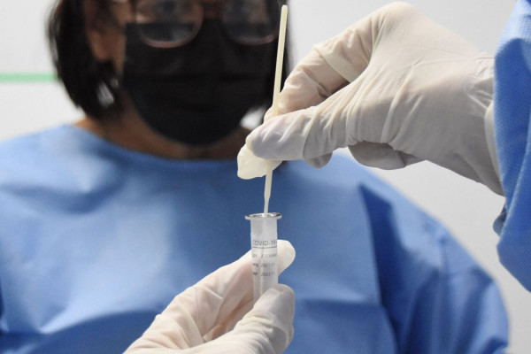 RJ: cenário epidemiológico de covid-19 tem tendência de redução