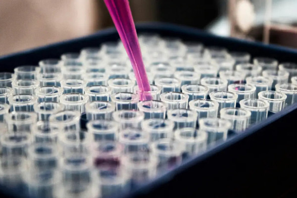 Estudo mostra que inflamação no cérebro pode ser chave do Alzheimer