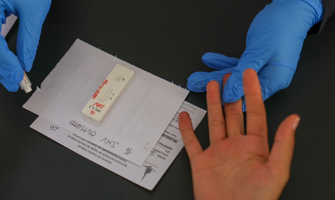 HIV/Aids: Brasil vai insistir em acordo por PrEP de longa duração