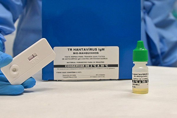 Novo teste faz diagnóstico de hantavirose em 20 minutos
