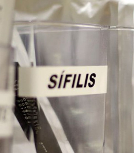 Centro de SP tem testagem grátis de HIV, hepatite, síflis e gonorreia