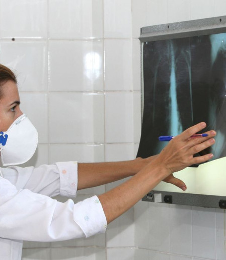 OMS recomenda testes de diagnóstico rápido para erradicar tuberculose