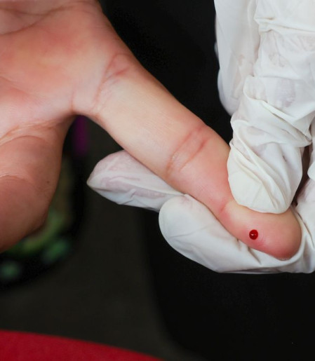 SUS passa a oferecer teste rápido de dengue 