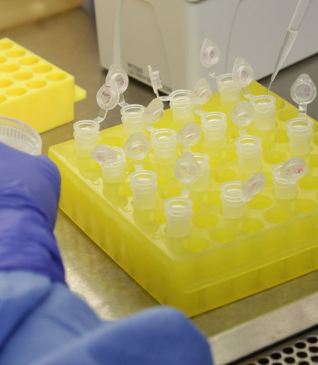 SP confirma segundo caso importado de sarampo