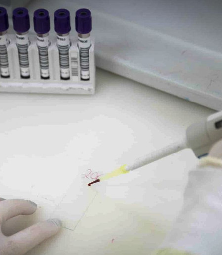 Paciente em SP com suspeita de ebola testa positivo para meningite