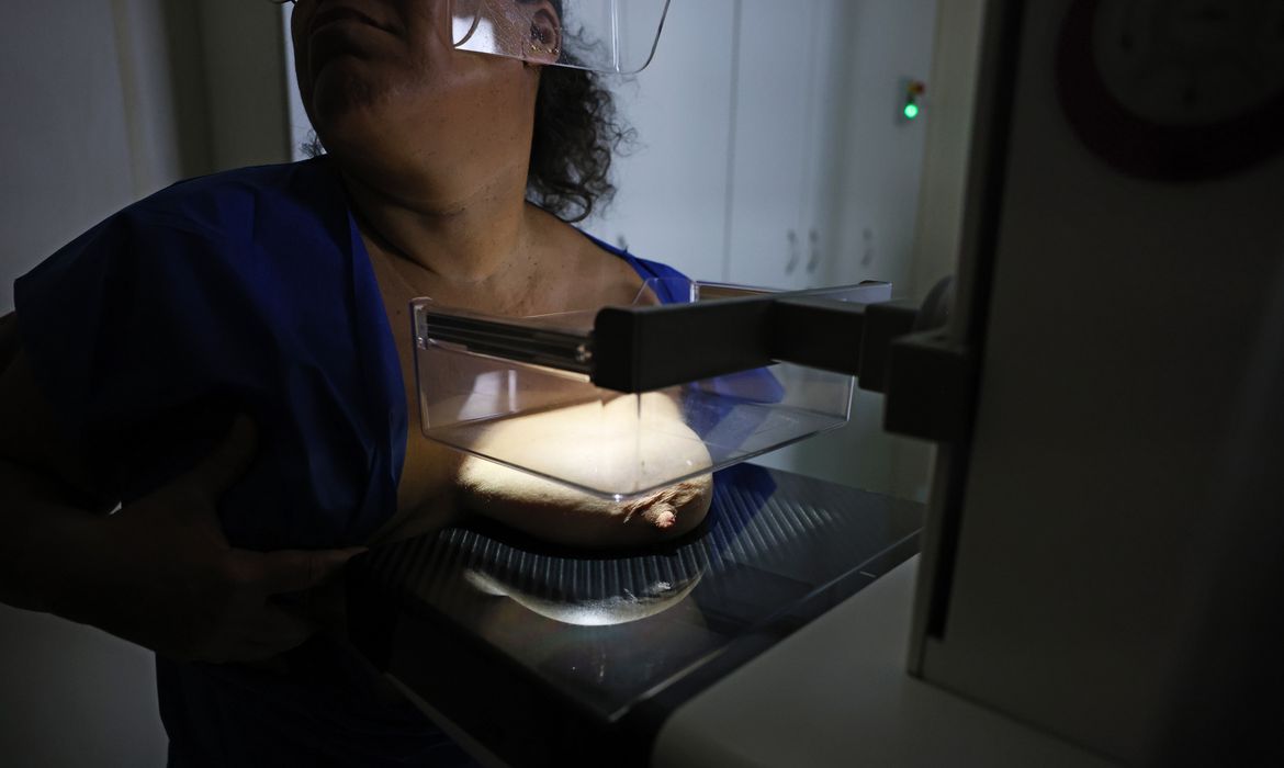 ANS defende que plano cubra mamografia digital sem restrição de idade