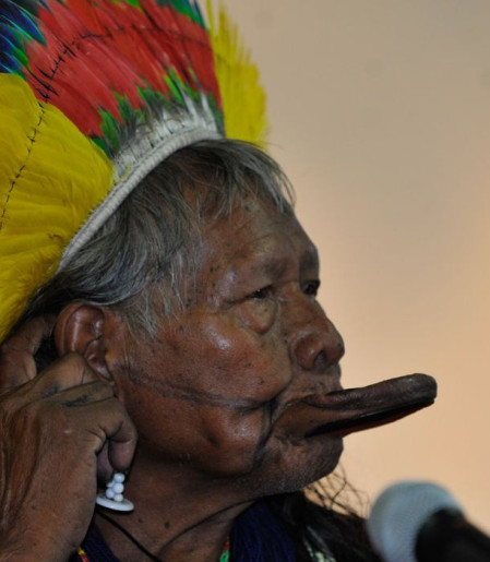 Cacique Raoni apresenta boa evolução clínica e vai para enfermaria