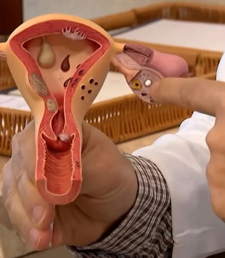 Aberta chamada pública para pesquisas sobre endometriose 