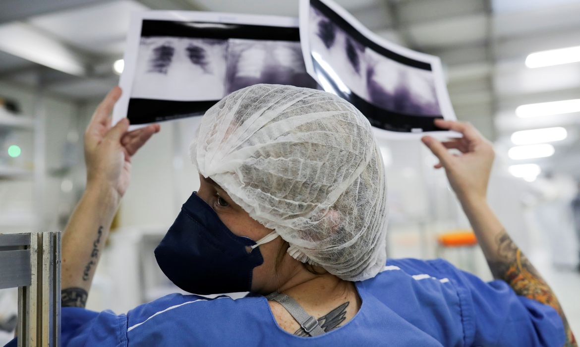 Diagnóstico tardio dá poucas chances de cura para o câncer de pulmão 
