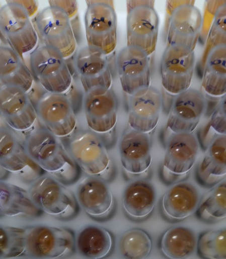 Uso de medicamento oferecido no SUS reduz casos de malária no Brasil