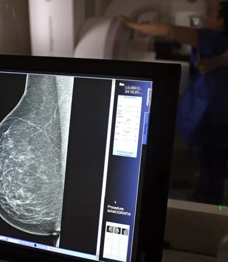 Plano de saúde terá que cobrir mamografia digital para todas as idades