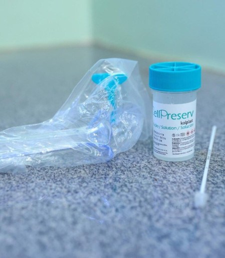 Exame identifica, no material coletado do colo do útero, o material genético de tipos de HPV 