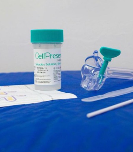 SUS detecta quase 10 mil testes positivos para HPV de alto risco